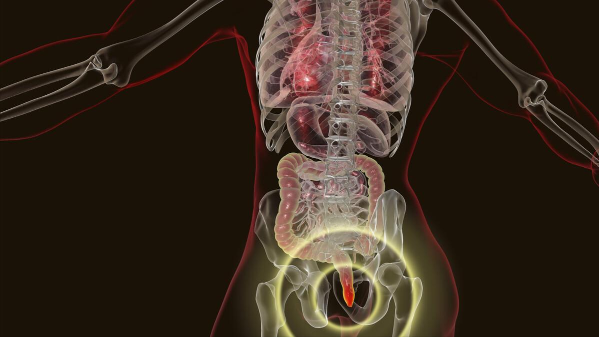 女性屁股中间毛太多，正常吗？能不能直接剃掉？医生劝你手下留情