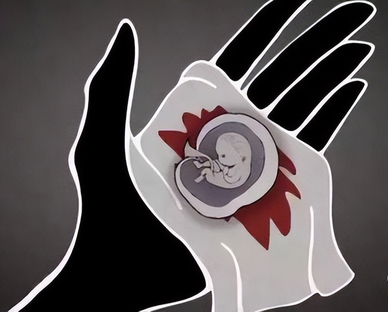 自己流掉的胎儿该怎么处理,做人流手术胎儿是怎么样的