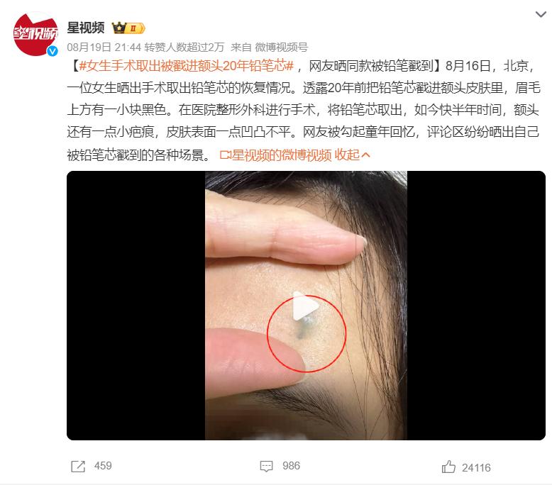 小孩儿手里扎进了铅笔芯怎么办,8岁小孩眼睛不小心被铅笔戳了