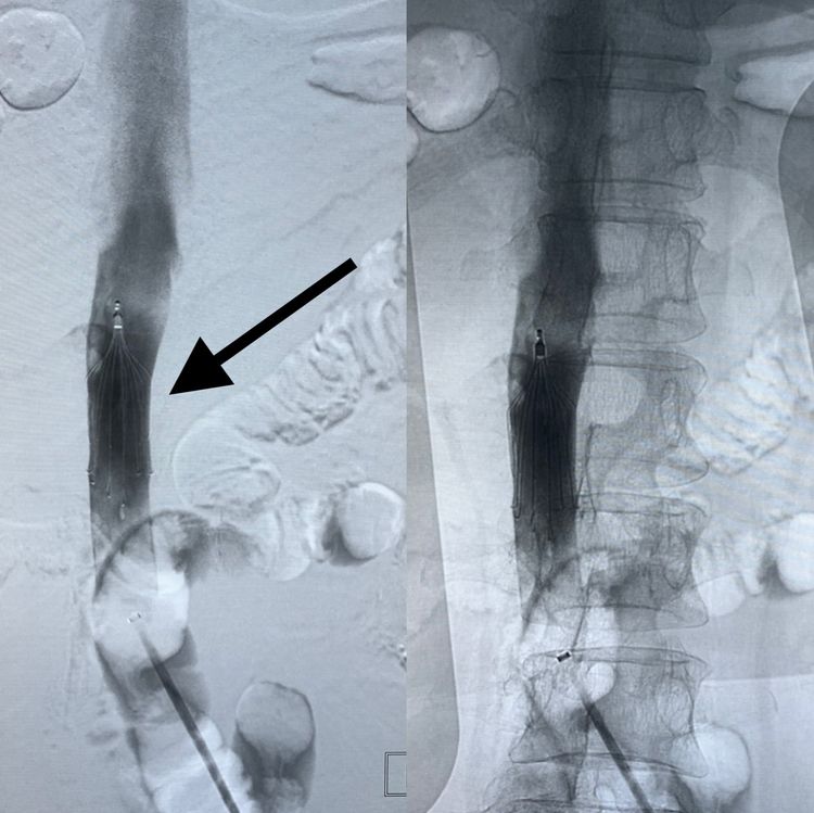 一个值得唠叨几句的病例