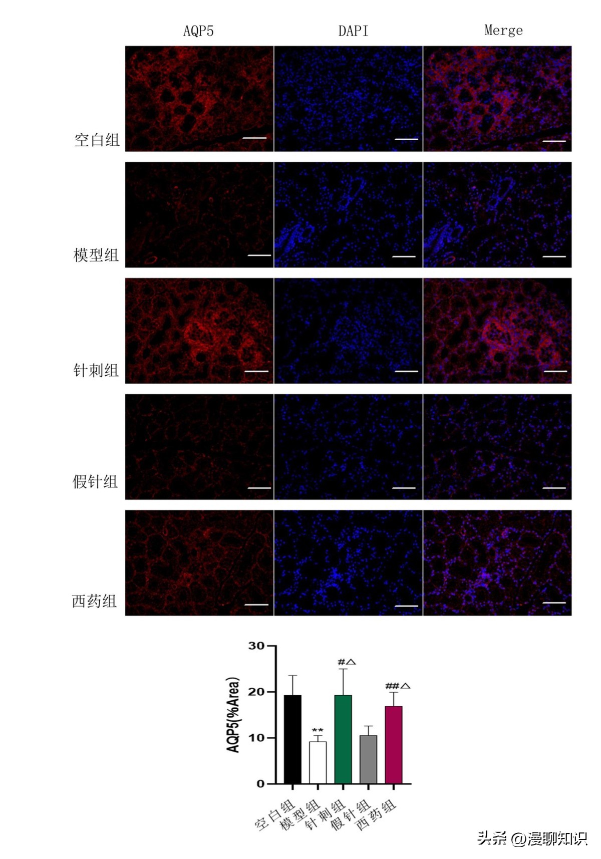 干眼就是干燥综合症吗,眼干涩视物模糊得了干眼怎么办