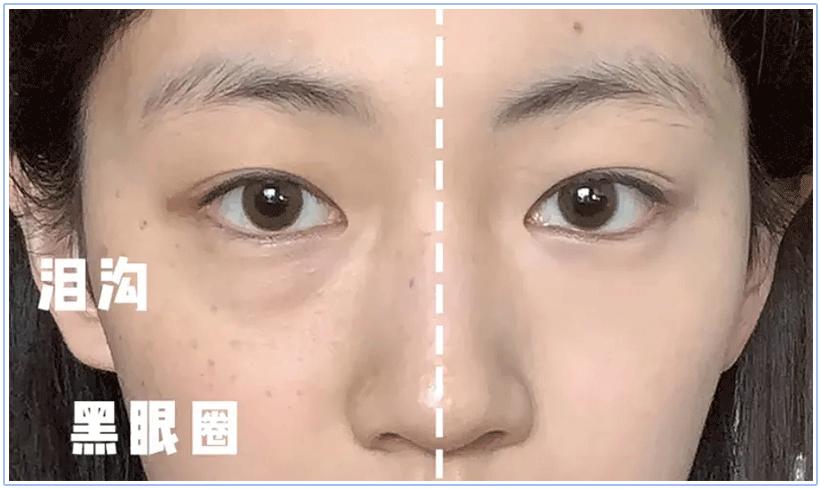 “羊”后敷面膜吸收效果增倍？医生朋友揭露3点，已经开始囤了