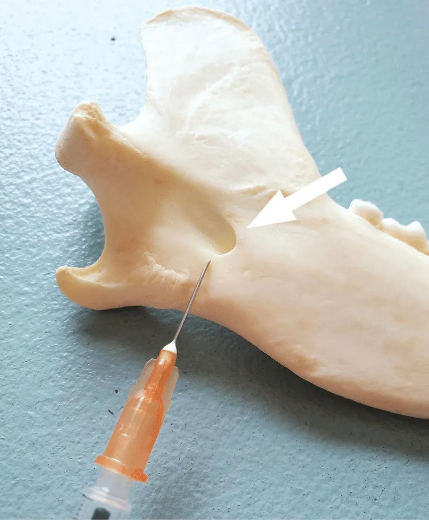 鐗欏懆鍙戠値鎬庝箞闀囩棝,鐗欏懆搴锋槸闀囩棝绫昏嵂鐗╁悧