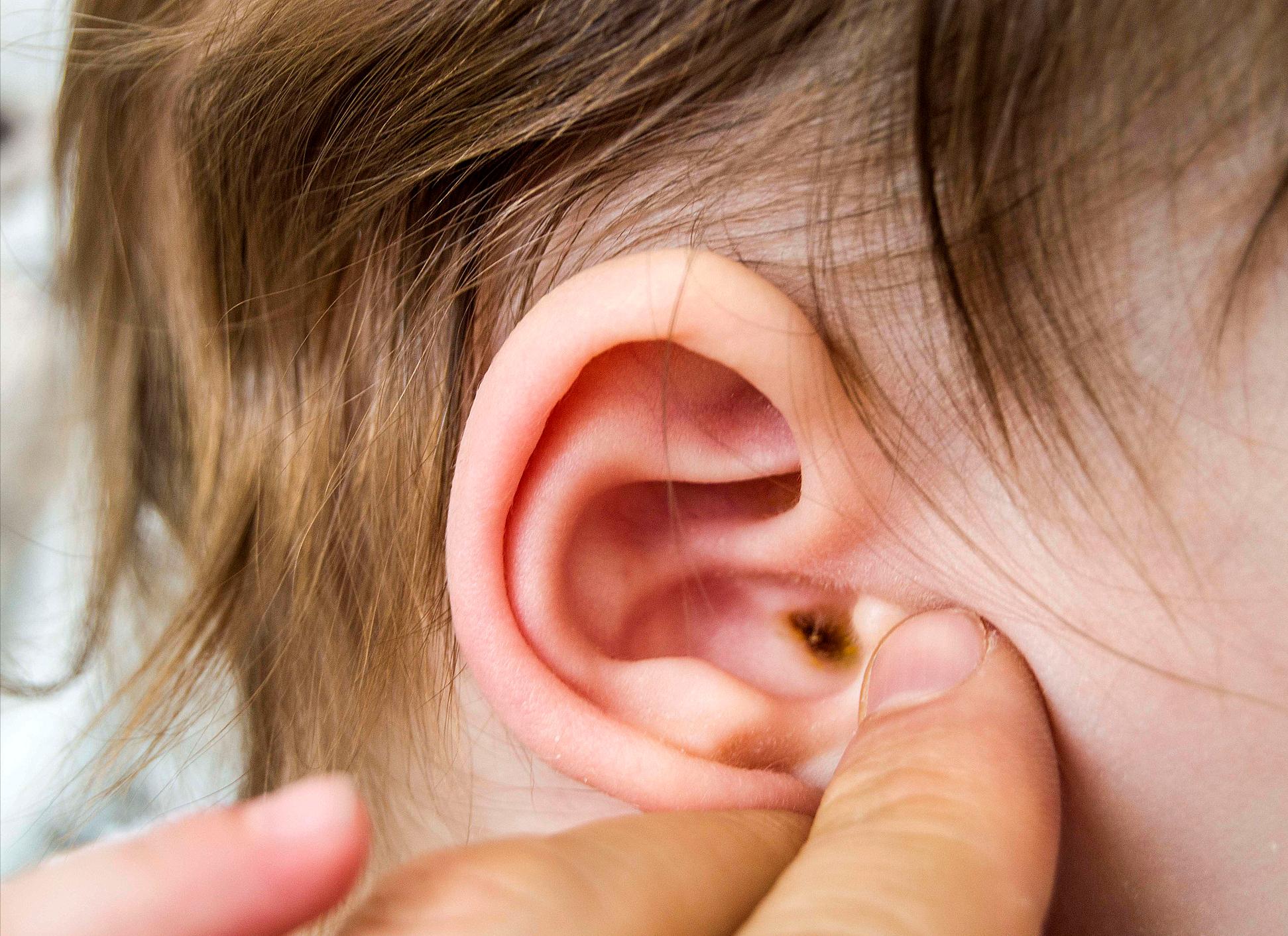 耳朵痒掏出来的东西潮湿有臭味,耳朵里太痒了掏出来臭臭的东西