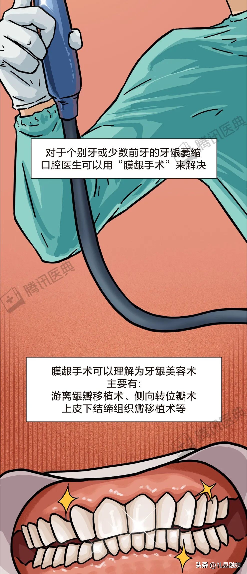 牙缝隙大吃菜就塞牙怎么修复,牙齿吃菜老塞牙怎么办