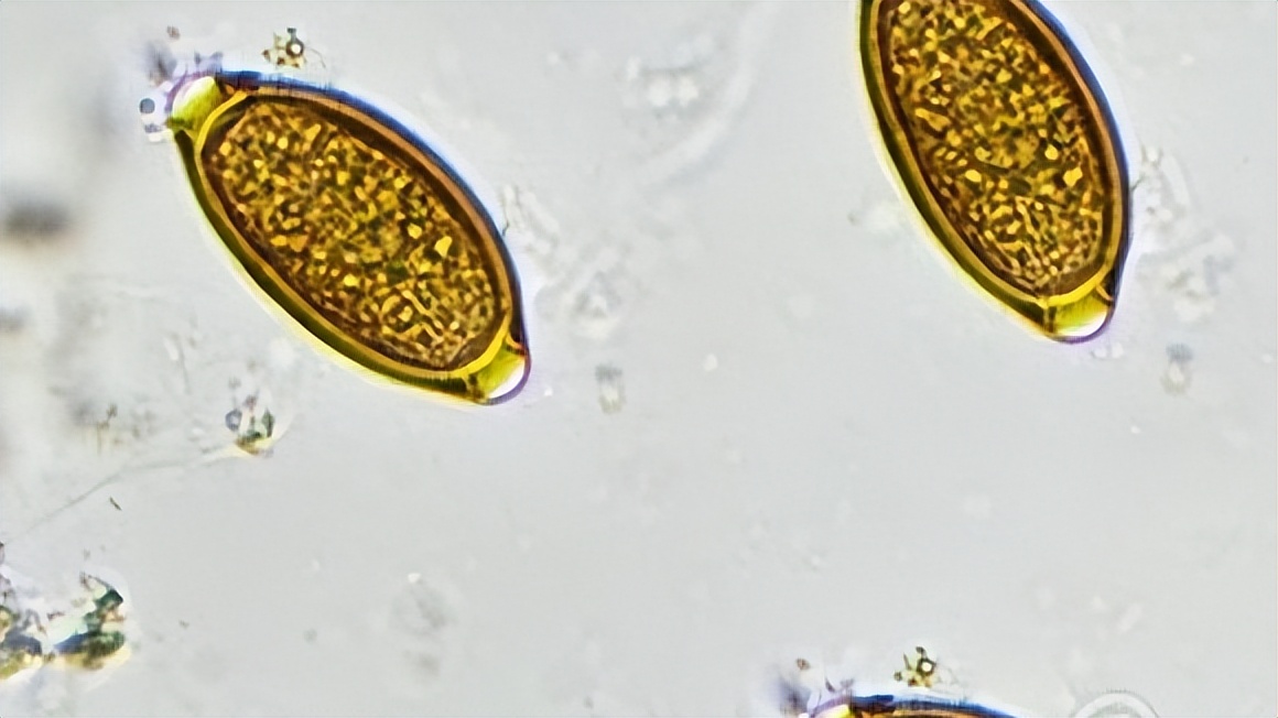 没有生活性超声检查建议做吗,身体没有不适需不需要做妇科检查
