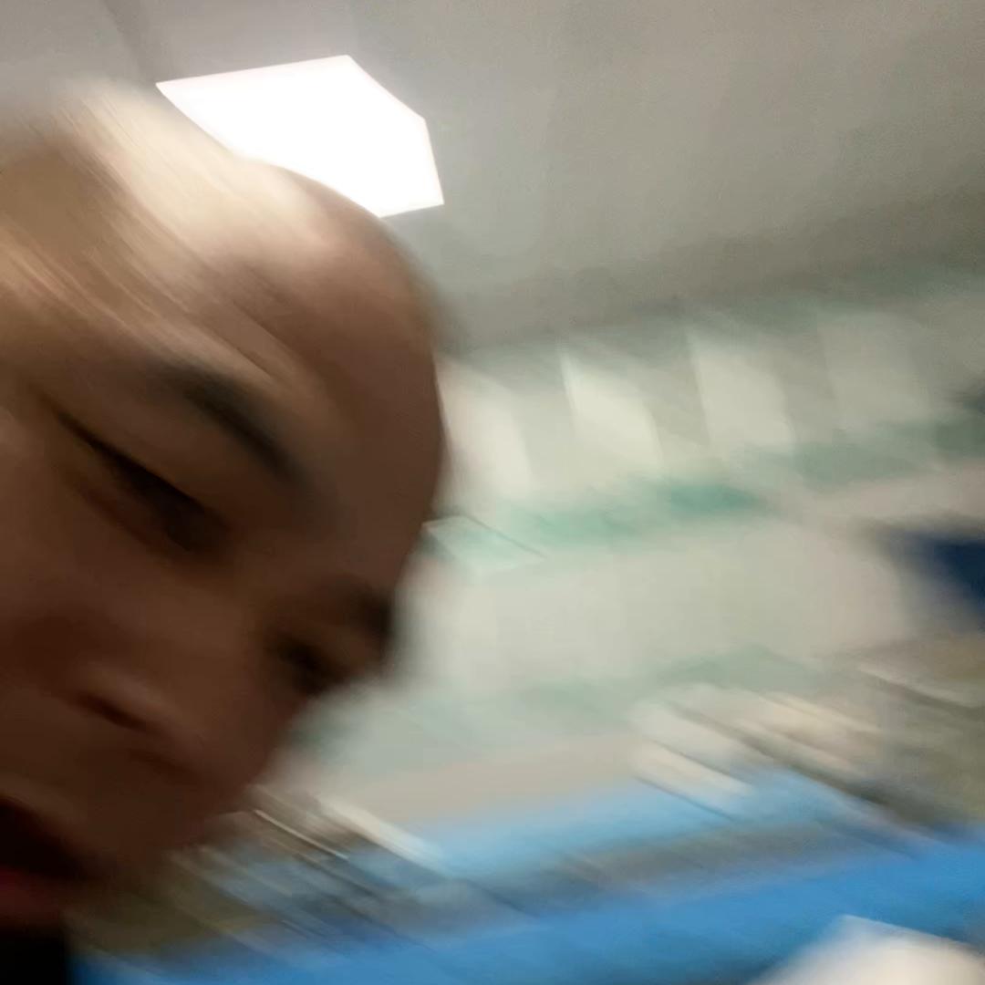 年龄大了腿摔劈了需要做手术吗,年龄大了走点路就腿疼是怎么回事