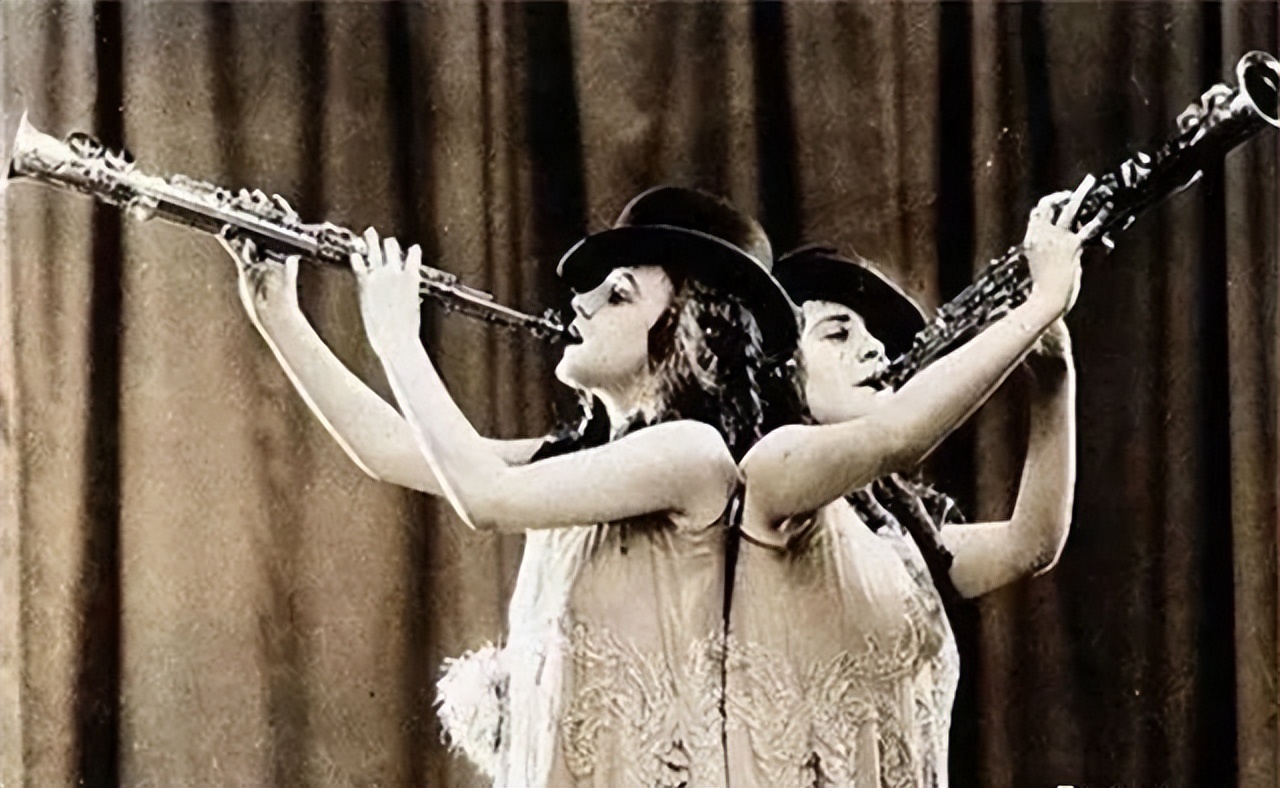 英国连体姐妹分离手术大结局,英国连体姐妹姐姐死后怎样