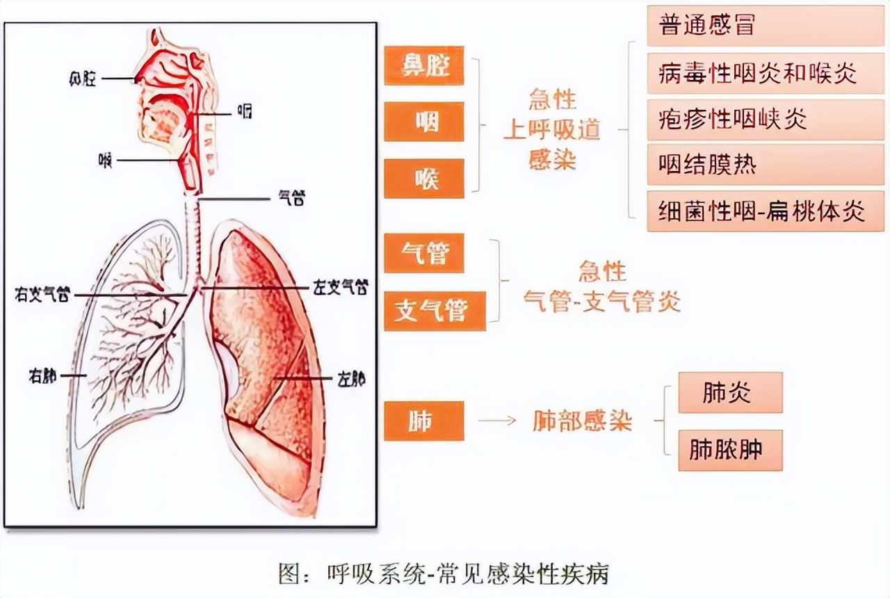 咳嗽痰多晚上发烧怎么回事,经常咳嗽需警惕哮喘