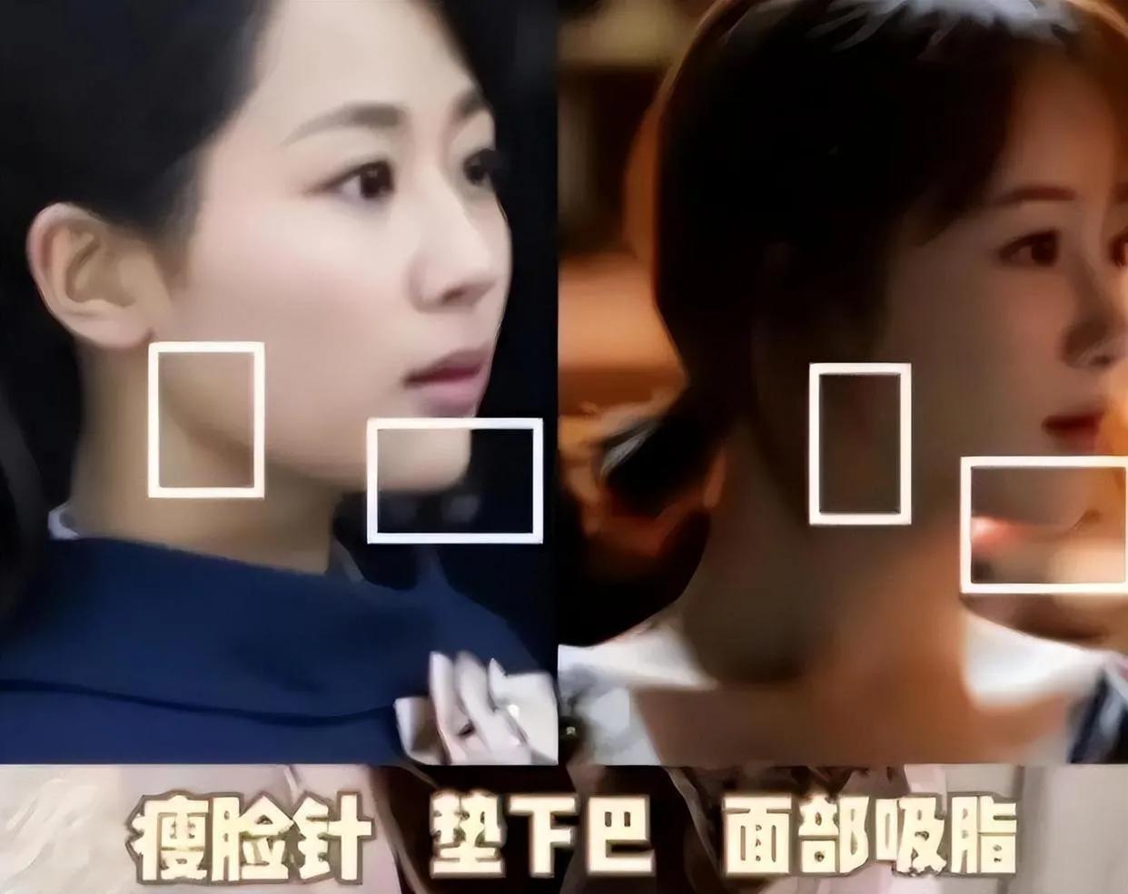 娱乐圈天然脸vs整容脸,娱乐圈没有整容的人纯天然的脸