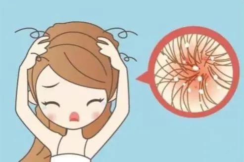 每天都有洗头，还是发痒有头屑甚至掉发？