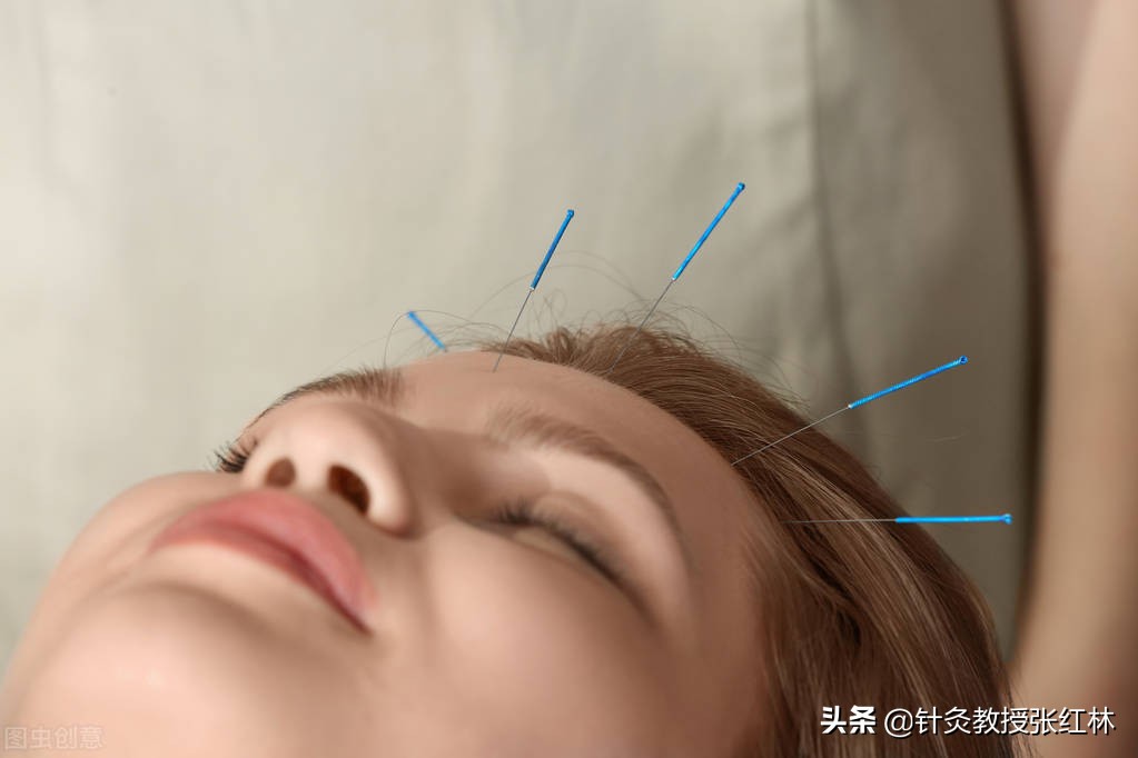 脐针灸治疗妇科病,妇科病针灸治效果好吗