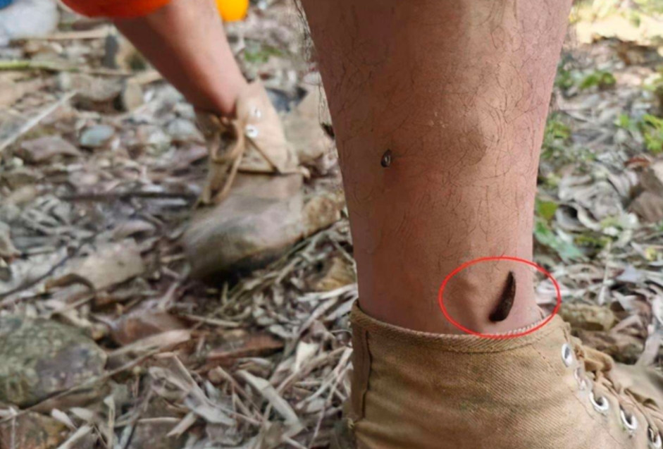 如果不小心把水蛭吞下会发生什么,把水蛭放进肚子里多久可以排出