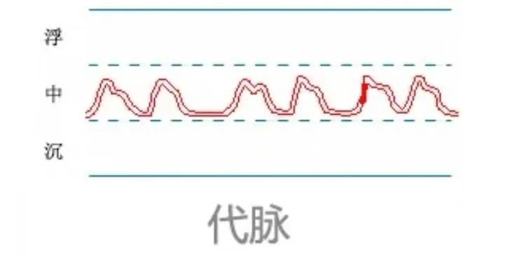 中医28脉诊歌诀及示意图,中医28脉全部脉象图解