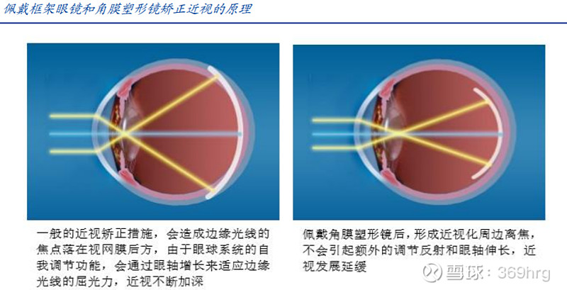 眼科用药的研究报告,眼科深度研究