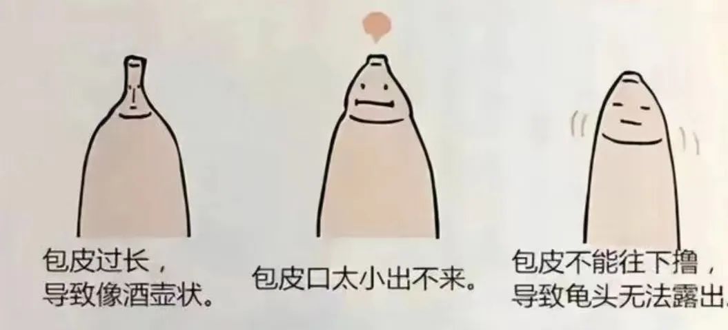 是不是所有的宝宝都要割包皮,出生的宝宝要不要割包皮