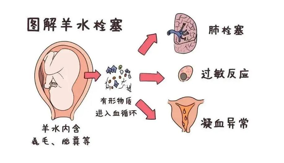 如果不避孕一辈子能生几胎,如果不备孕女子能生多少孩子