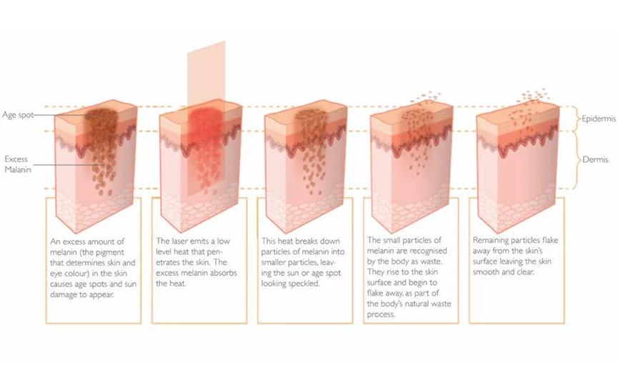 白瓷娃娃美白嫩肤,什么是白瓷娃娃美白嫩肤
