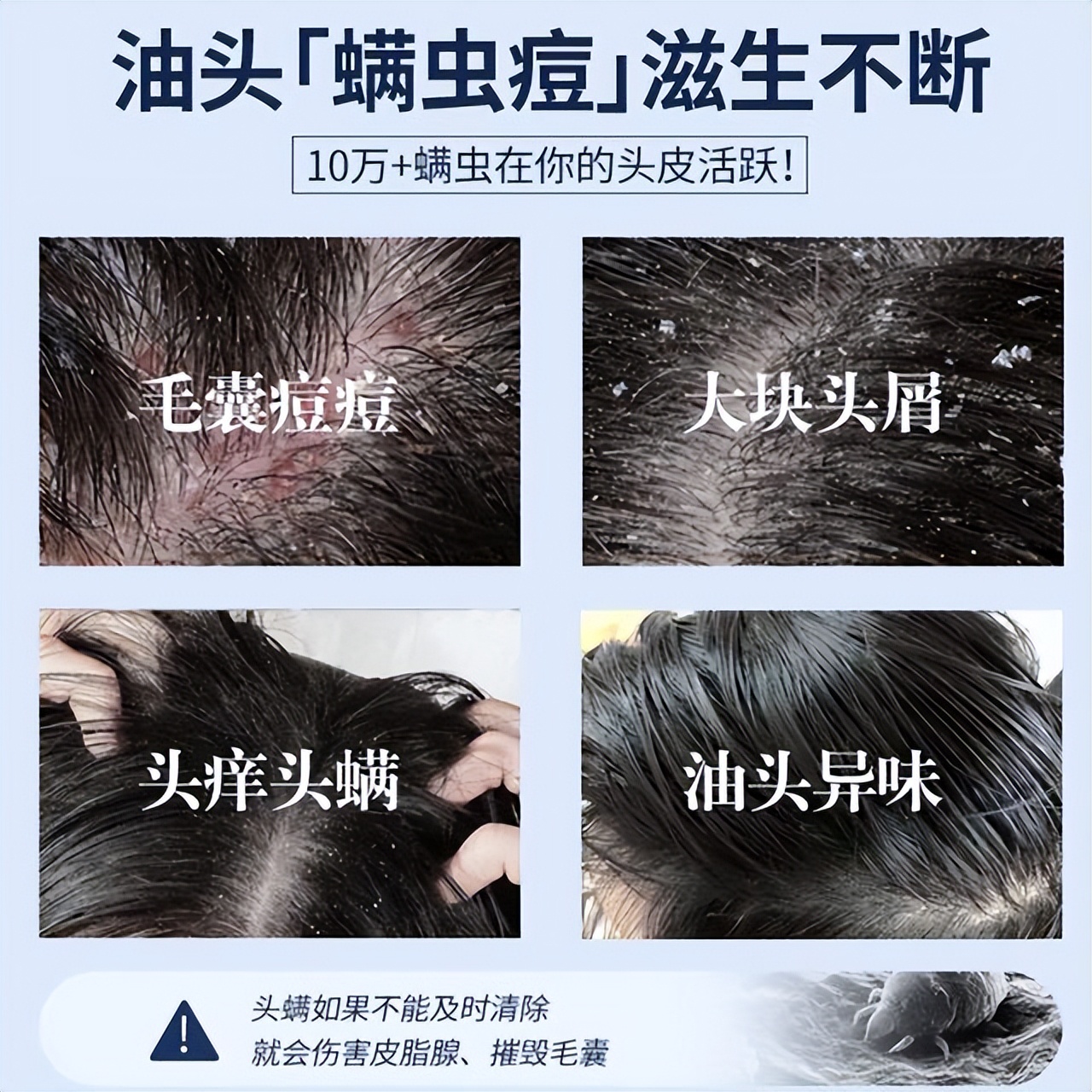 洗头皂止痒控油,洗头皂测评真实推荐排行榜第一名