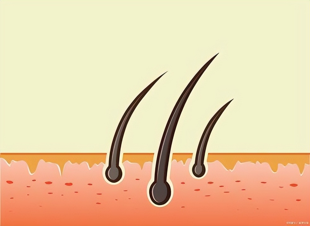 白头发的人不易得癌症是真的吗,为什么白头发不能拔迷信说法