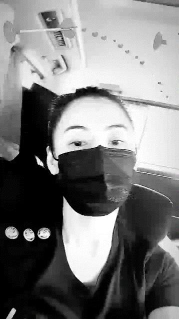 张柏芝被宠物狗咬脸,张柏芝小儿子受伤