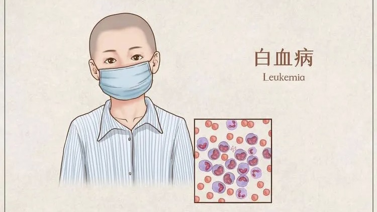 【健康】“大姨妈”又爱又恨，异常子宫出血到底是怎么回事？