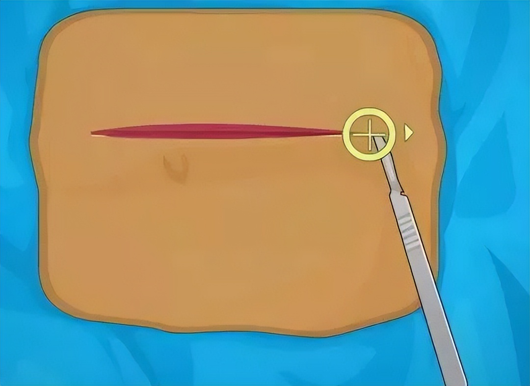 手术时，为啥切开皮肤几乎不出血，生活中稍微划破就会流血呢？