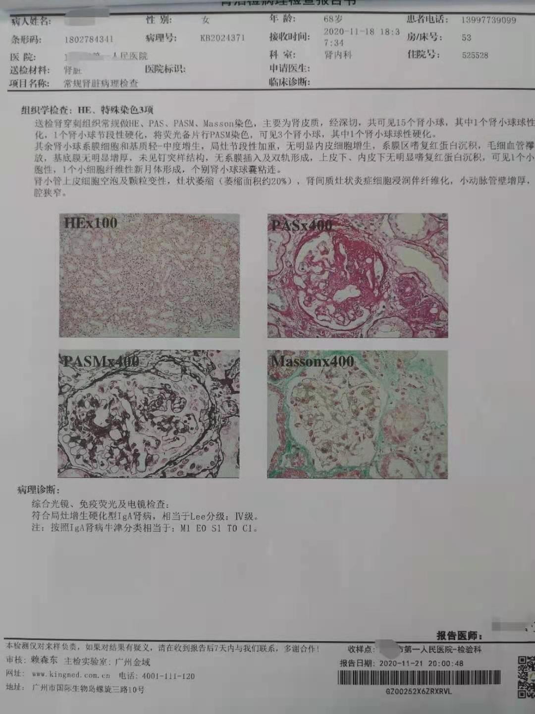 尿液有泡沫是肾病需要怎么治疗,尿里有泡沫是不是肾病复发了