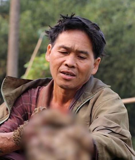 男子得了怪病身上长了树枝,男子患怪病手脚长得像树枝