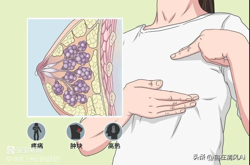 哺乳期涨奶怎么办,哺乳期奶胀的解决方法