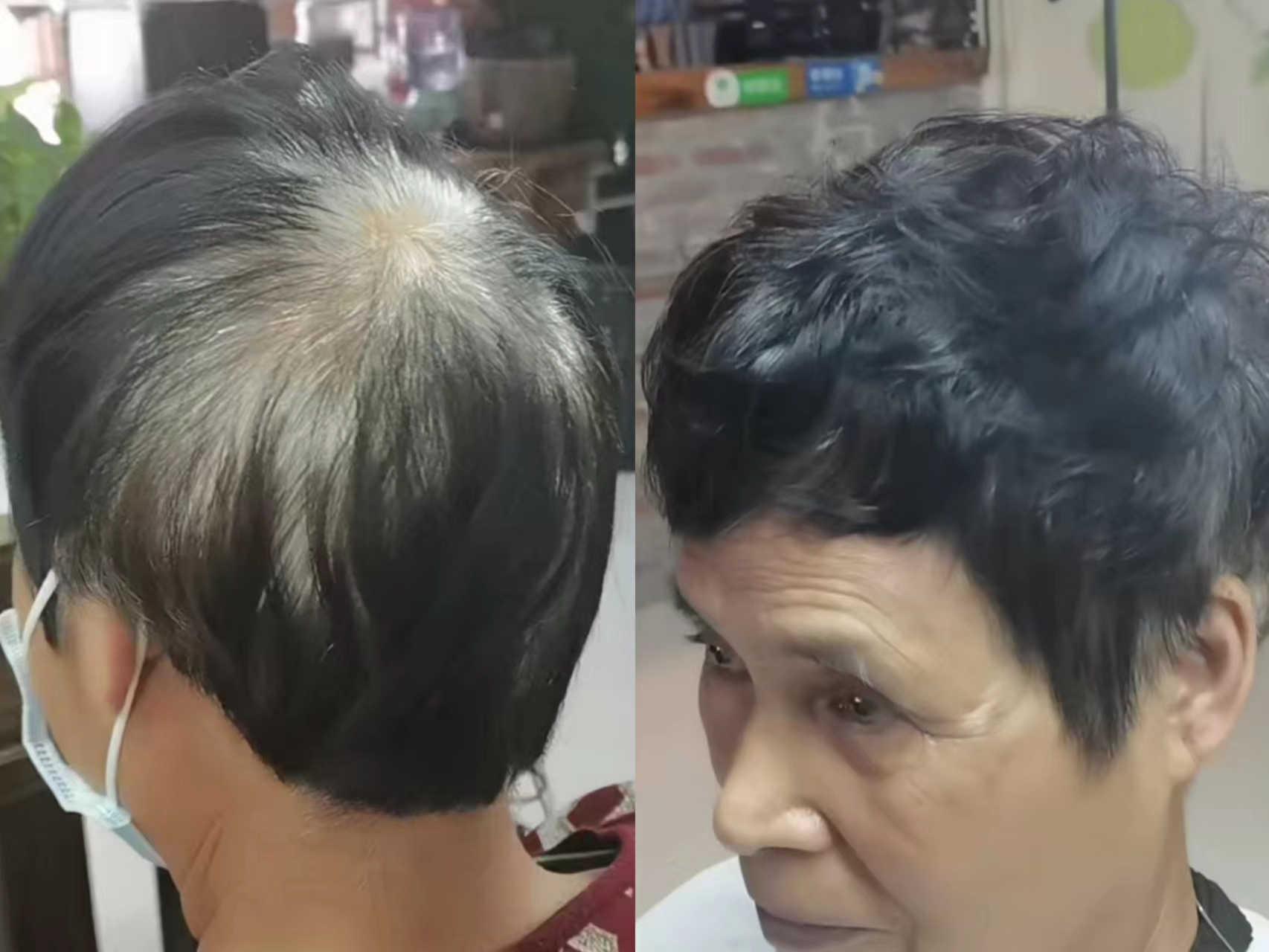 老年人白发烫什么发型好,老人冷烫满头卷短发发型