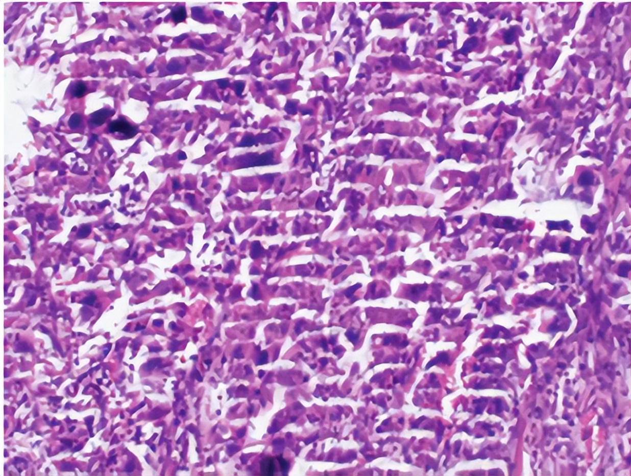 石蜡组织切片的注意事项,为什么石蜡切片不连贯