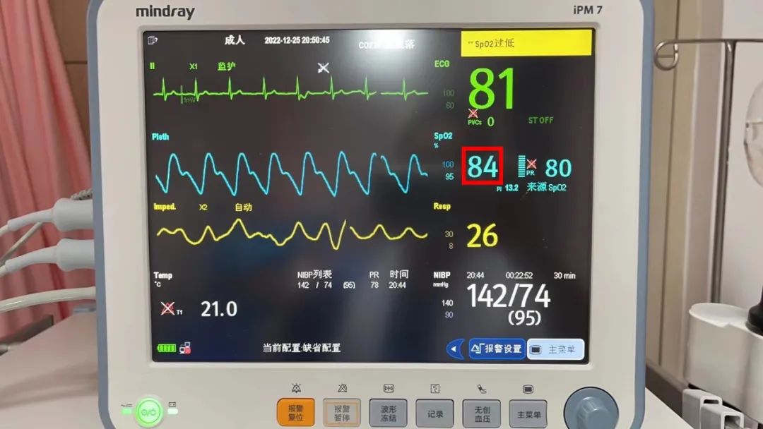 第一胎剖腹产的宝妈,咳嗽咳到剖腹产的刀口那里疼了