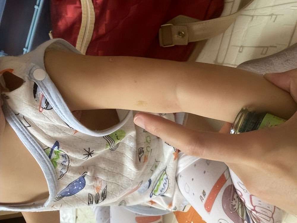 宝宝驱蚊膏植物,宝宝驱蚊神器驱蚊贴