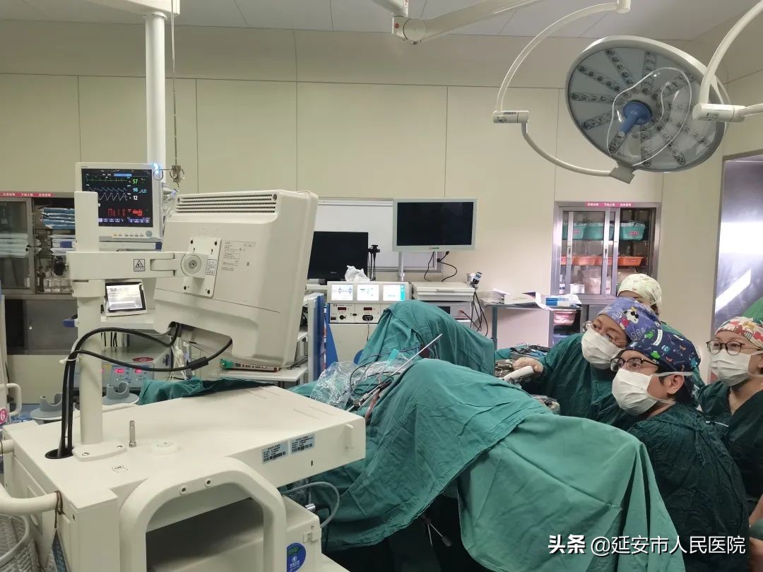 延安市人民医院妇产科三病区成功开展经阴道腹腔镜全子宫切除术