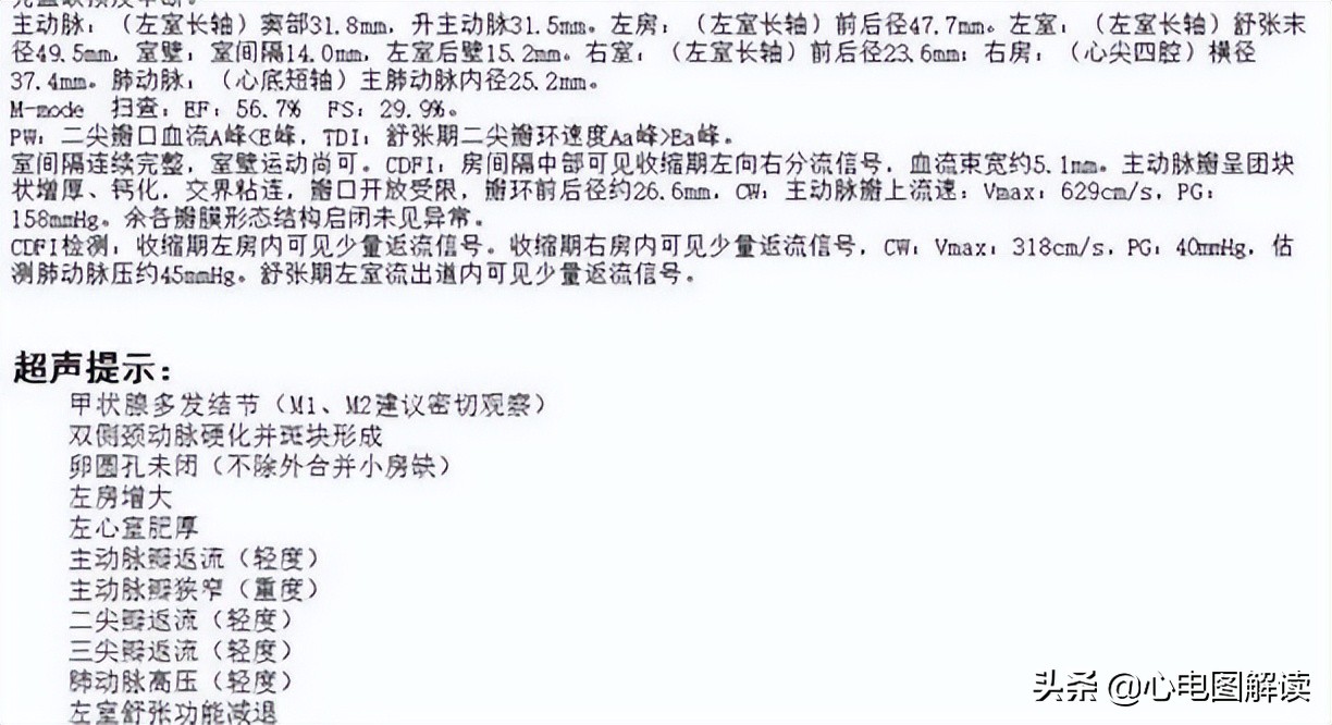 t型波异常什么意思,t波改变类型