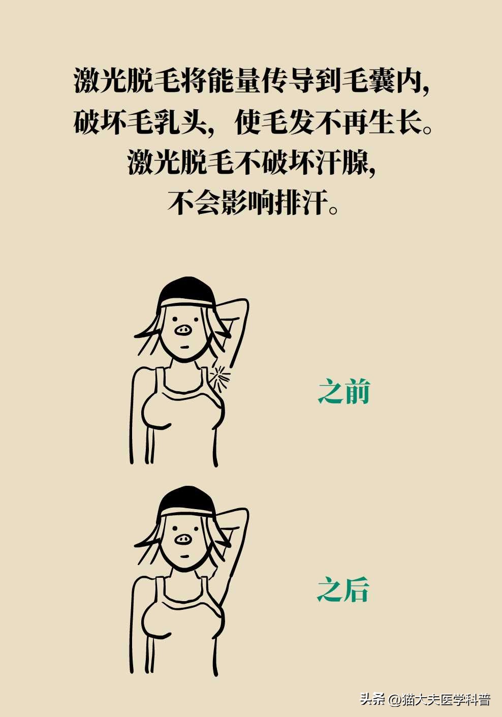 激光永久脱毛一般多少钱,永久激光脱毛是不是骗人的