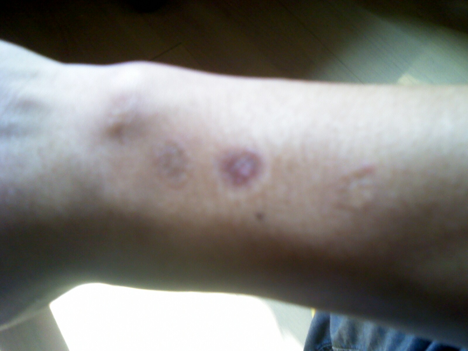 马登毅骗术截图,马登毅最后留下烟疤