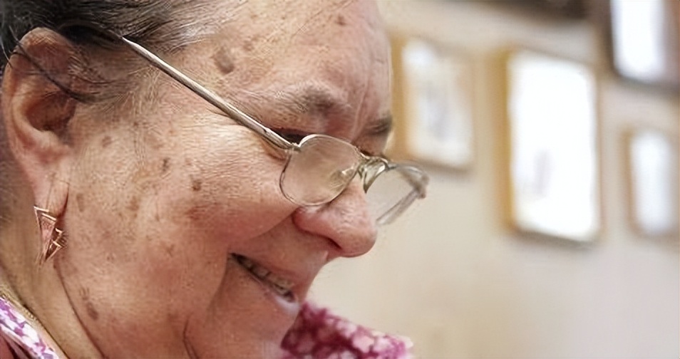 红霉素软膏祛老年斑小妙招,红霉素软膏原来是老年斑克星