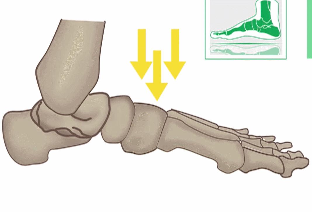 为什么现在的鞋越来越磨脚,原来合适的鞋穿久了也会磨脚