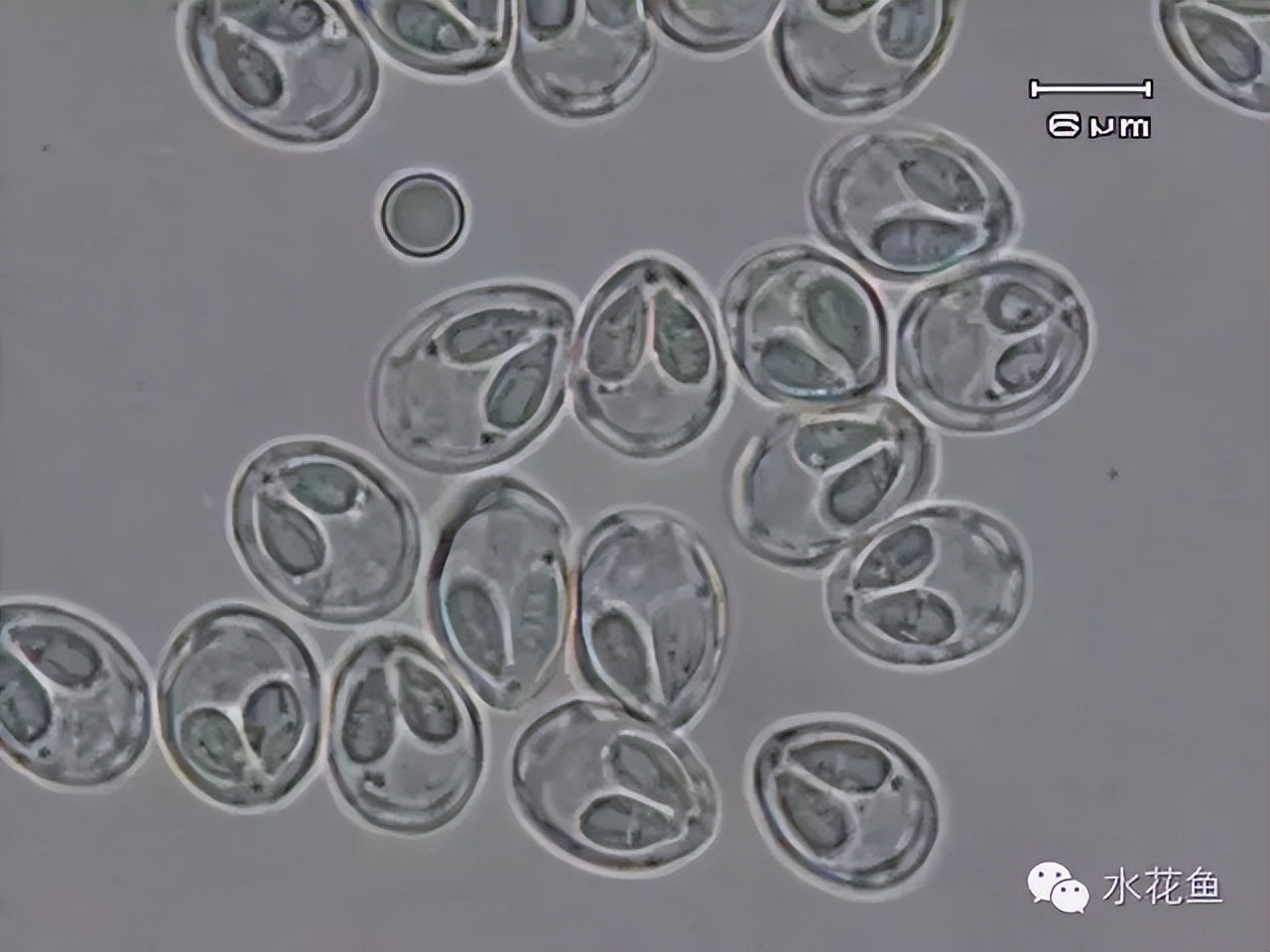 鱼身上长锚头鳋虫图片,锚头鳋孢子虫