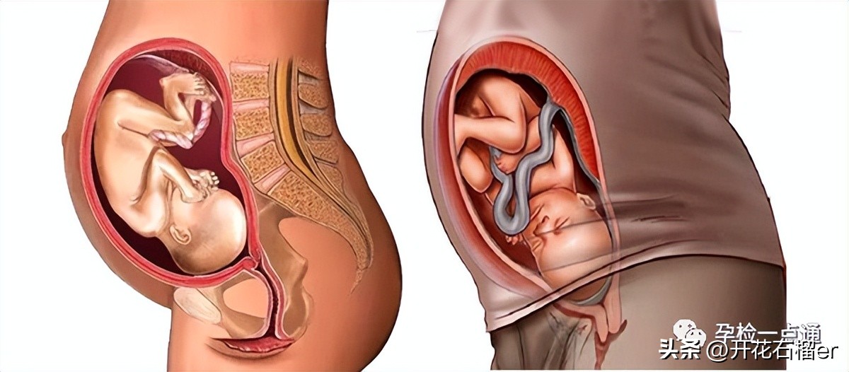 不懂经常摸自己孕肚没事吧,怎么摸肚子能感觉到胎儿在动