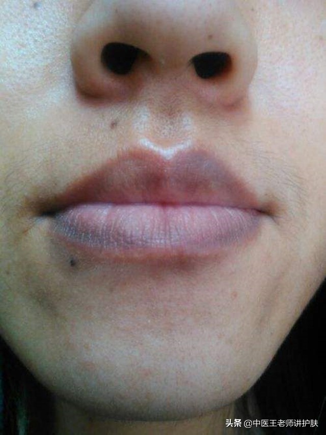 什么药能祛斑脸色暗黄,有什么方子能去暗黄