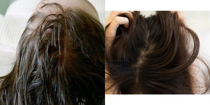 去屑蓬松控油洗发水测评学生党,用了五六年的洗发水真心推荐