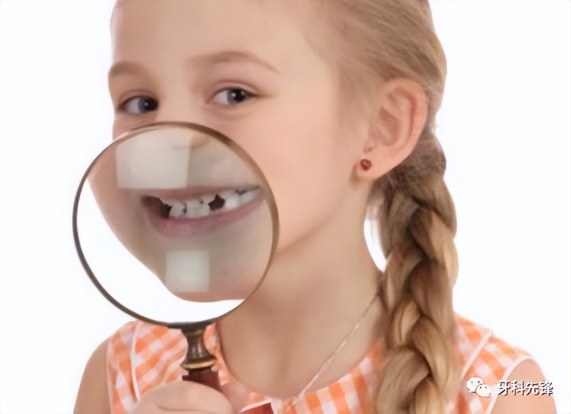 家长必知的儿童口腔知识,健康宣教口腔知识
