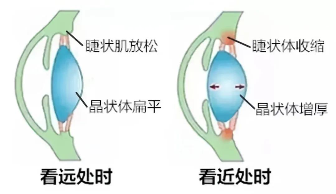 眼干眼疲劳怎么护眼,眼干眼疲劳怎么缓解
