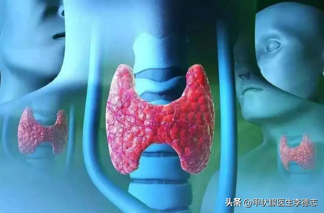 甲状腺知识课堂电话,甲状腺肿大最好的治疗方法有哪些