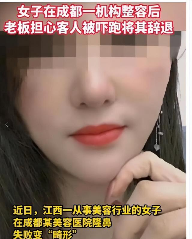 整容朝天鼻成功案例,朝天鼻整容失败案例