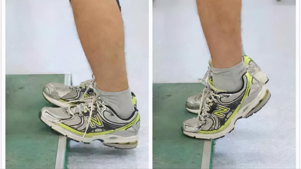 宝宝鞋跟外侧轻微磨损,鞋跟外侧磨损严重是足外翻