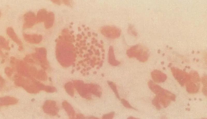 阿莫西林跟头孢是抗生素吗,阿莫西林和头孢哪一种消炎好